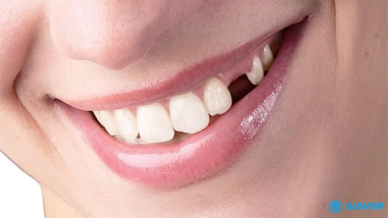 Mơ thấy rụng răng chứa bộ số đề theo từng tình tiết mơ