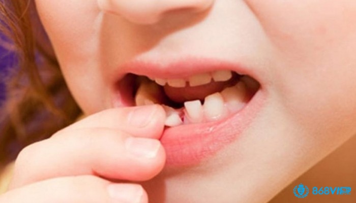 Mơ thấy rụng răng giúp gia chủ trúng đậm chiều nay